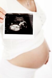 pregnancy ultrasound